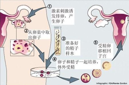 供卵代怀代生机构
